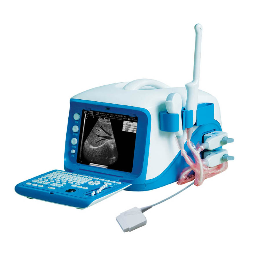 Cheap Digital Portable Ultrasound Doppler