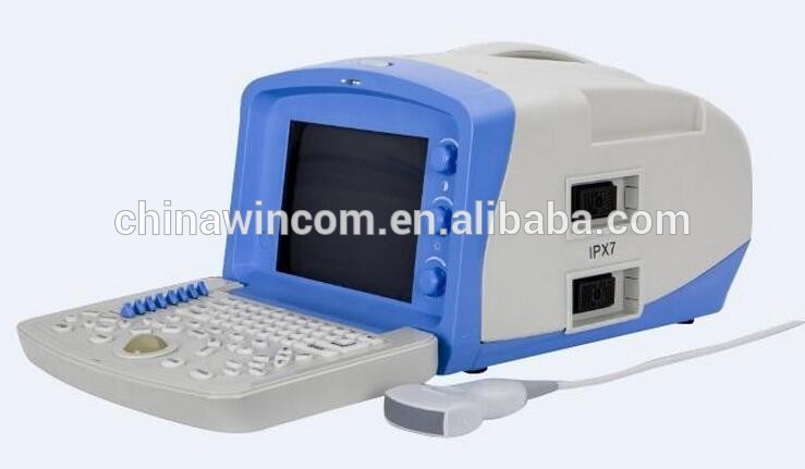 High Performance Medical Ultrasound Scanner Price from China Supplier