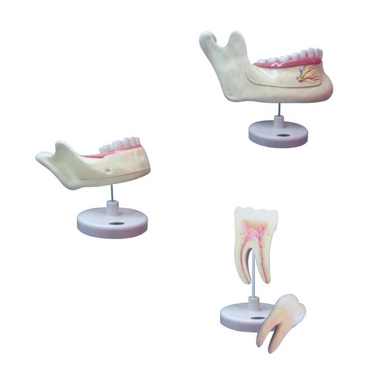 Dentes Model