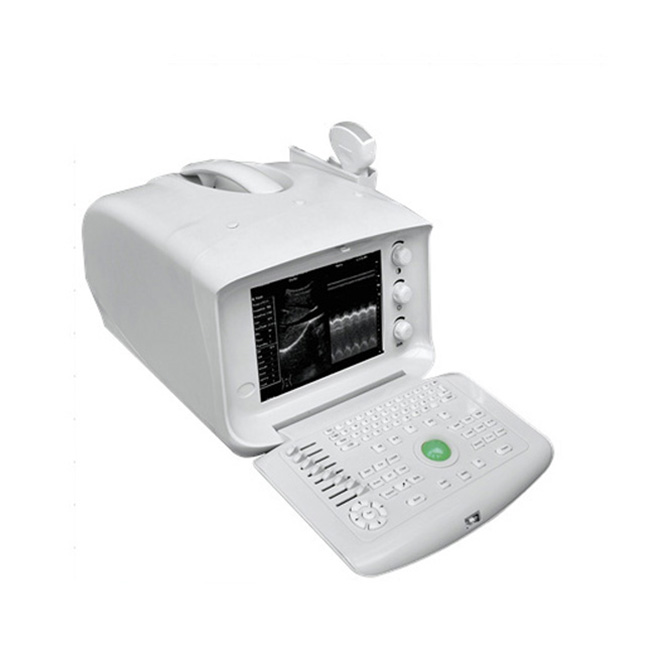 Digital Portable Ultrasound Scanner With 10 inch LCD Monitor 51353B