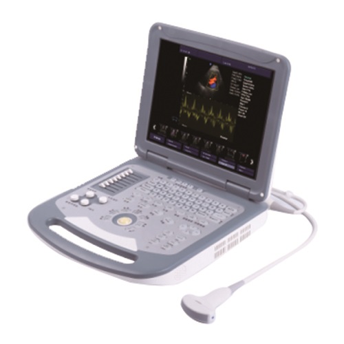 China Hot Selling Notebook Color Doppler 15inch LCD Display Ultrasound Scanner with batarry WT6800 Price