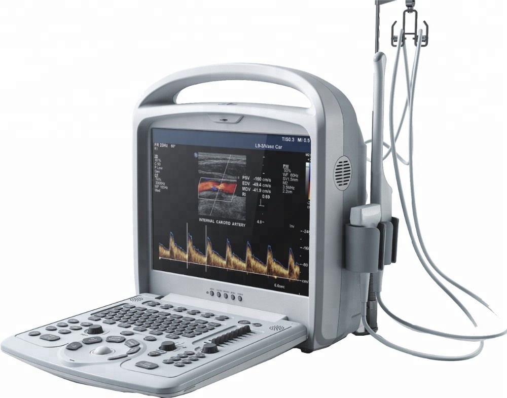 Color Doppler Ultrasonic Diagnostic System for WT-9200B