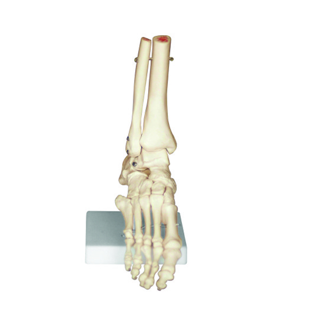 Foot bone,the bones of foot,hand teaching bone
