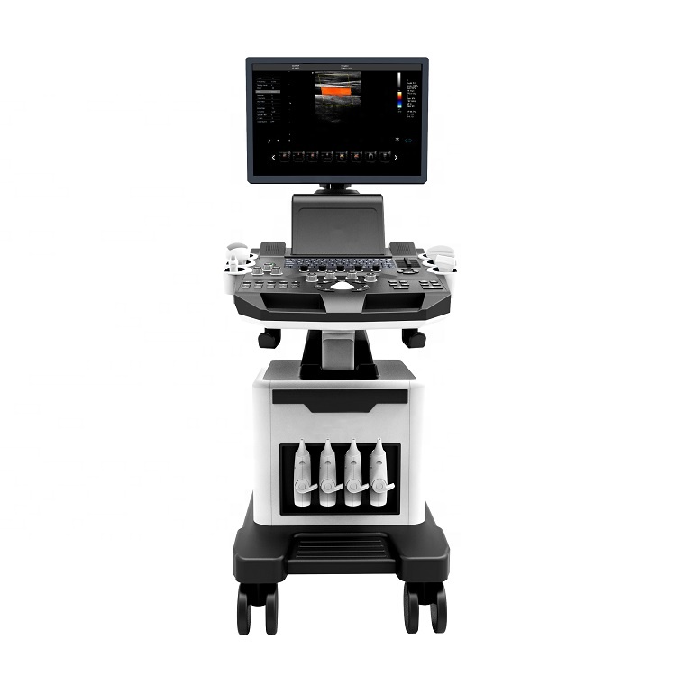 3D/4D Color Doppler ultrasonography