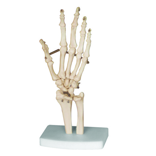 Teaching model of Bone of The Hand LM1040