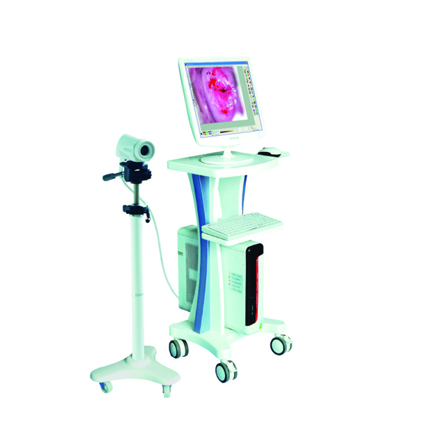 Movable Digital Electronic Coslposcope