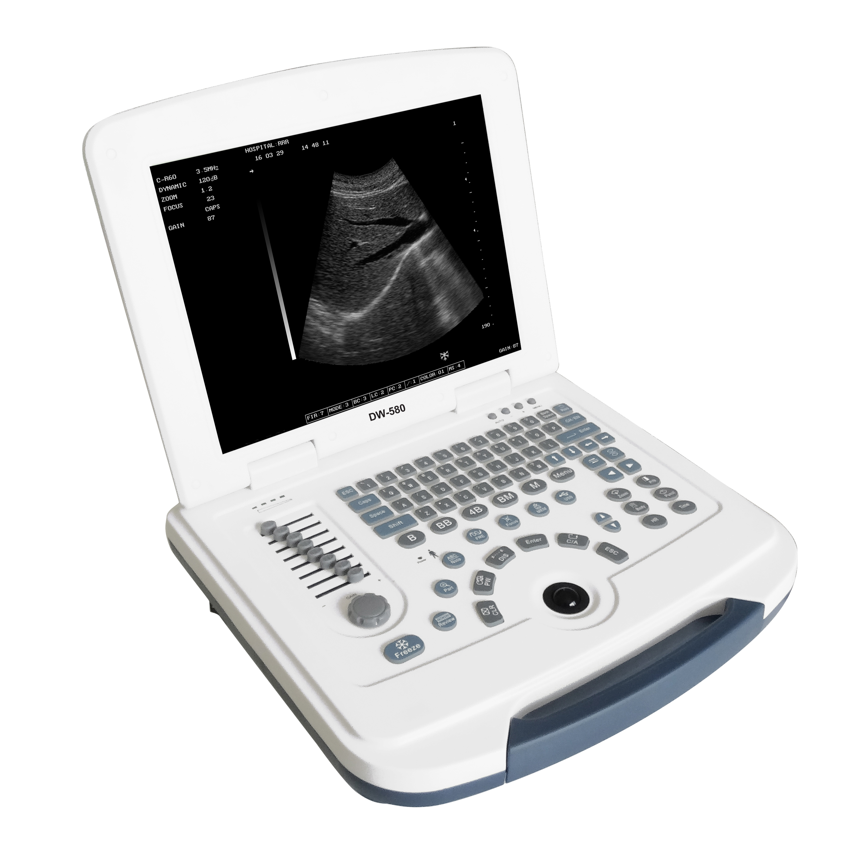 Notebook Diagnostic Ultrasound Scanner