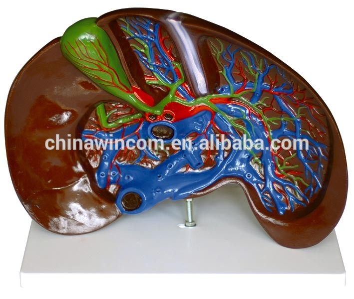 Liver Anatomical Model,Medical Ligaments of Liver