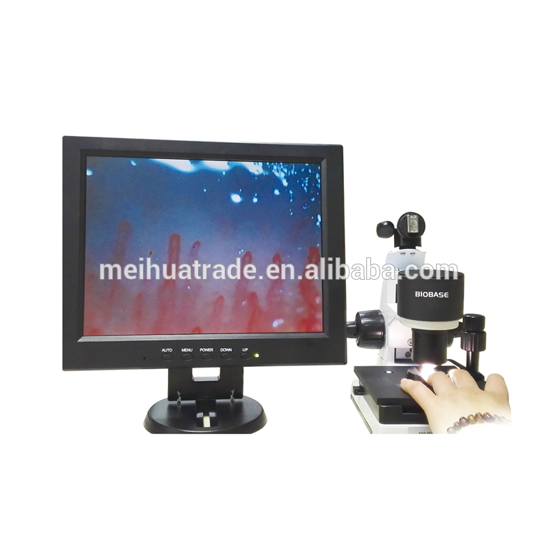 BIOBASE nailfold video blood capillary health care microcirculation microscope with ce certificate
