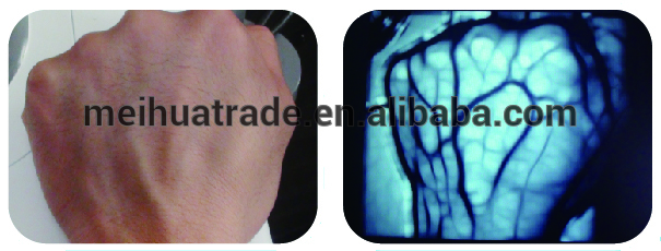 NEW LAB /Medical Vein Imaging Device /infrared vein finder for venipuncture with factory price