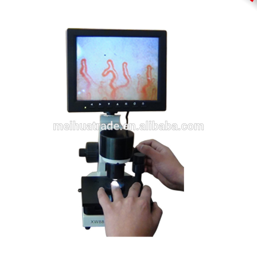 BIOBASE Cheap Price Blood Capillary Microcirculation Microscope