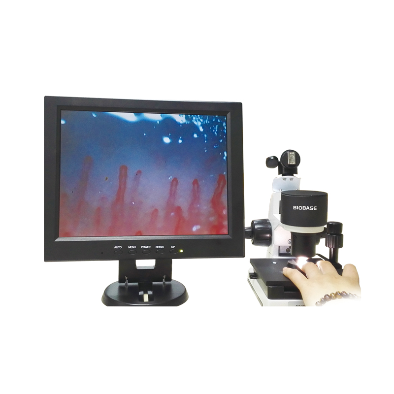 Portable nailfold capillary microcirculation microscopes with CE Certificate