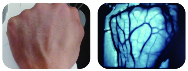 BIOBASE Hot Sale Table Top Vein Imaging Device or Veinviewer