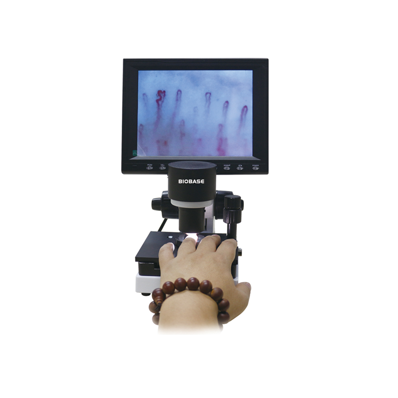 BIOBASE Cheap Easy Carry Analysis Digital Microcirculation Microscope